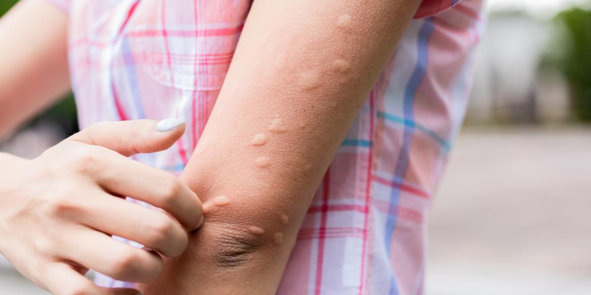 El truco definitivo para librarte de los mosquitos en verano: así debes utilizar la canela según la experiencia de esta abuela 1 629489ccbeb56