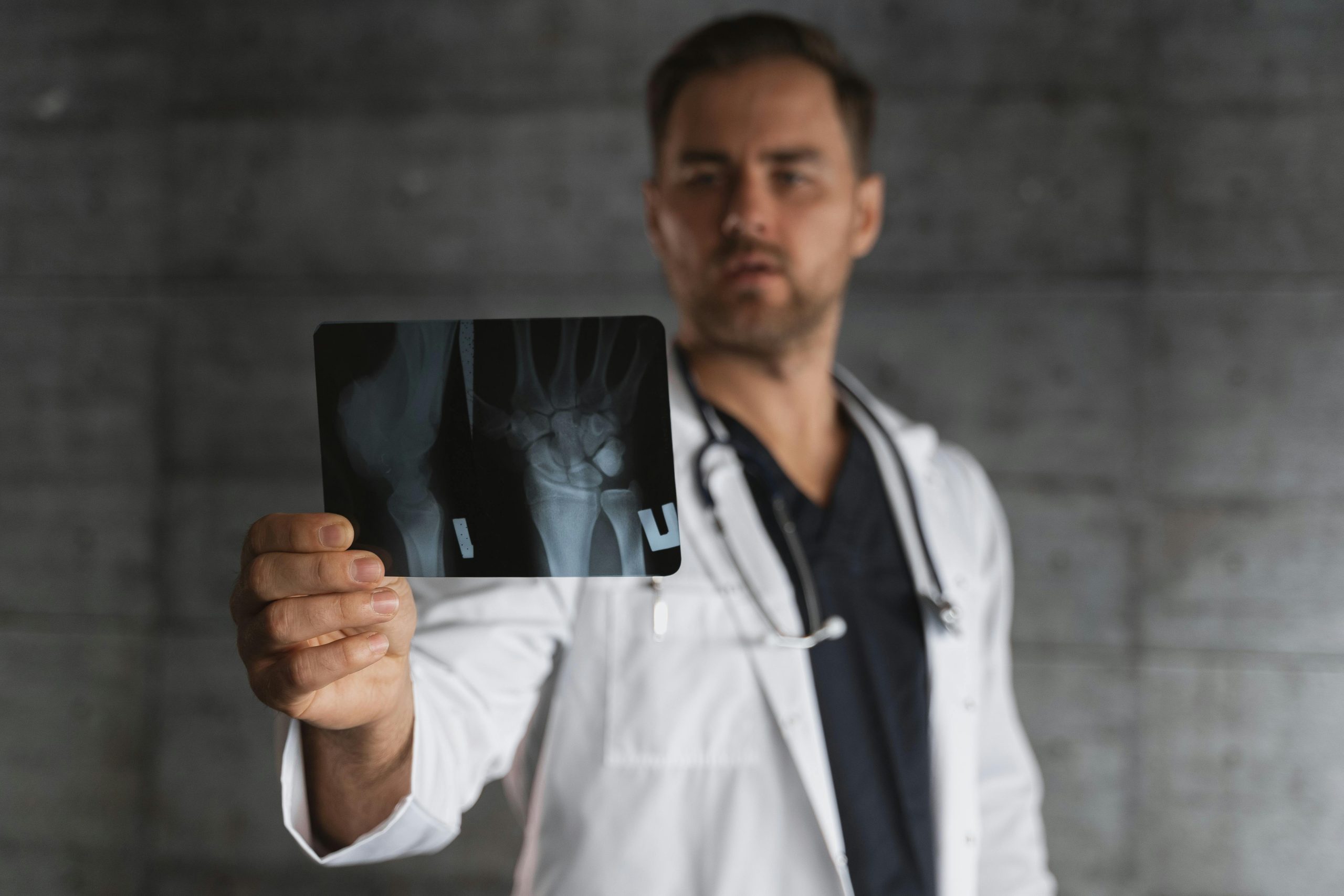 Descubre el Innovador 'Pegamento Óseo' que Revolucionará la Reparación de Fracturas: Un Avance Científico Asombroso