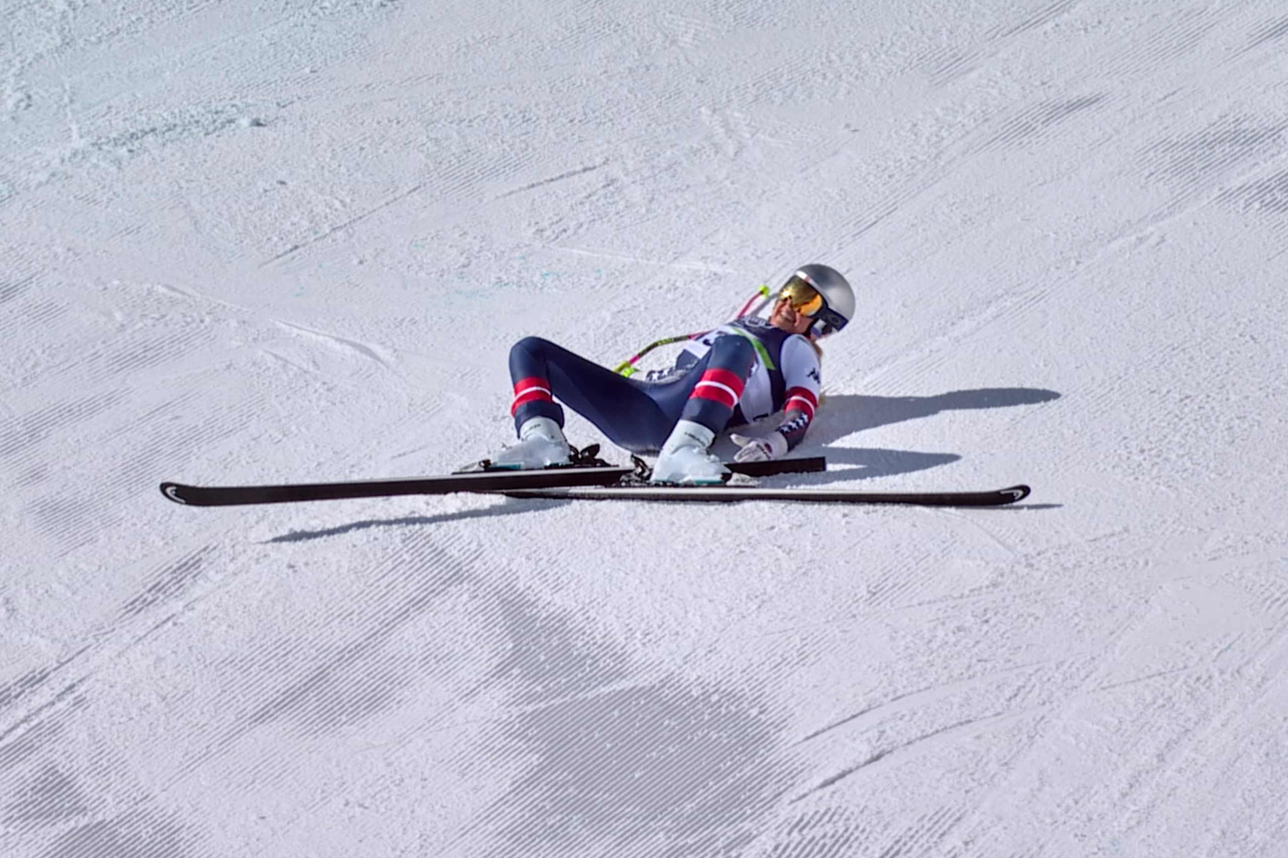 Vonn in the operating room: An Olympic return cut short by the fracture