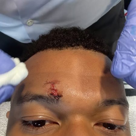 Mbappé, el héroe herido: Real Madrid y Girona empatan en un duelo polémico
